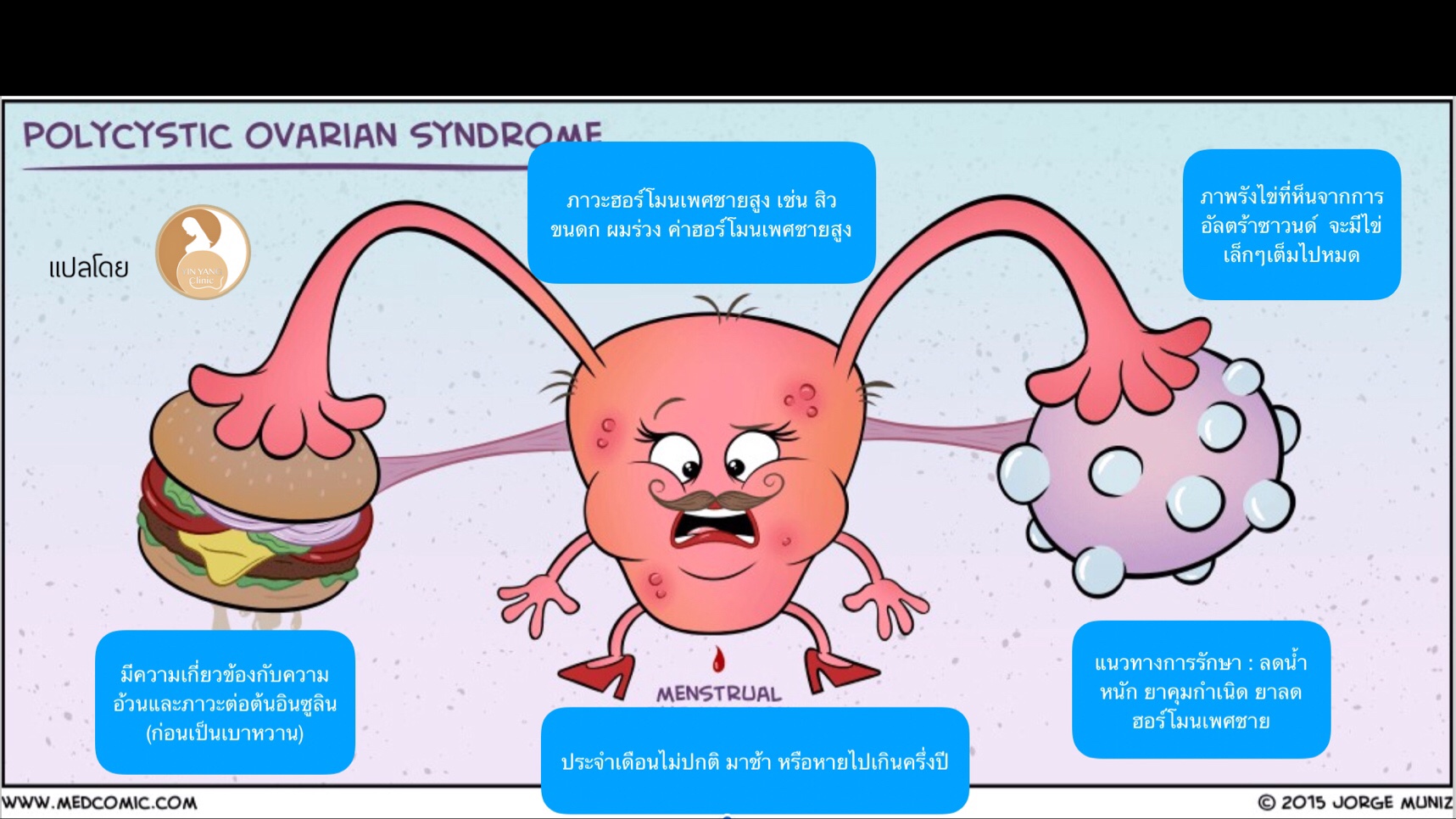 การรักษาโรคประจำเดือนมาไม่ปกติ ไข่ไม่ตกเรื้อรัง PCOS และมีบุตรยากด้วยแพทย์แผนจีน