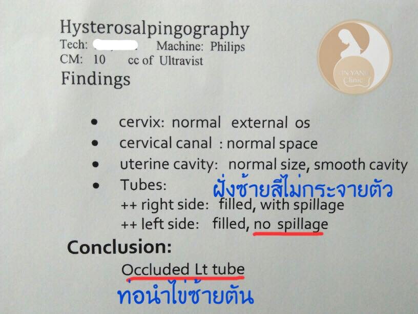 แพทย์แผนจีนกับการรักษาท่อนำไข่ตัน